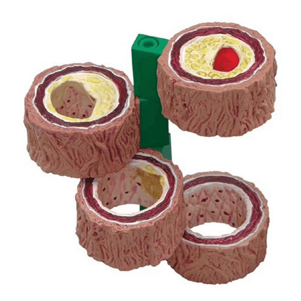Modelo Anatômico de Artéria Humana 4 Peças - NutriPulse