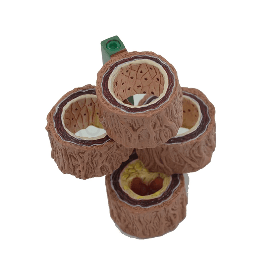 Modelo Anatômico de Artéria Humana 4 Peças - NutriPulse