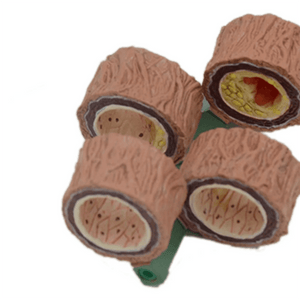 Modelo Anatômico de Artéria Humana 4 Peças - NutriPulse