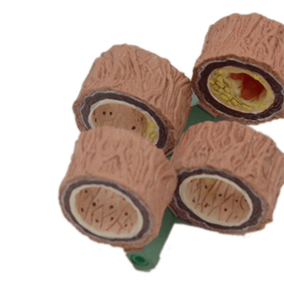 Modelo Anatômico de Artéria Humana 4 Peças - NutriPulse